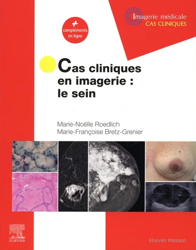 Cas cliniques en imagerie : le sein