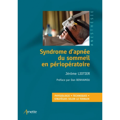 Syndrome d'apnée du sommeil...
