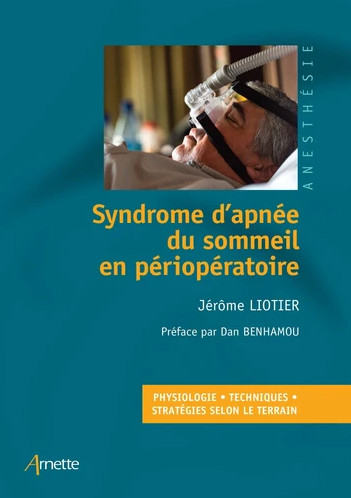 Syndrome d'apnée du sommeil en périopétatoire