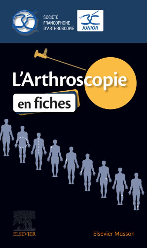 L'arthroscopie en fiches