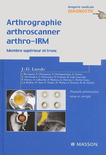 Arthrographie, arthroscanner, arthro-IRM