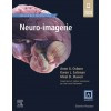 Neuro-imagerie