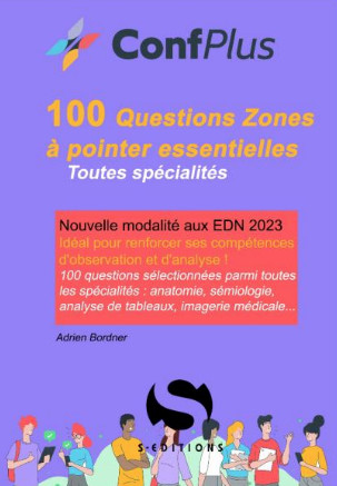 100 questions zones à pointer essentielles