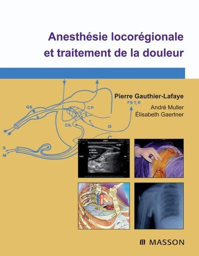 Anesthésie locorégionale et traitement de la douleur