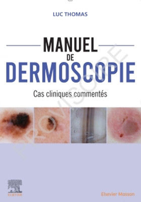 Manuel de dermoscopie