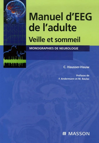 Manuel d'EEG de l'adulte