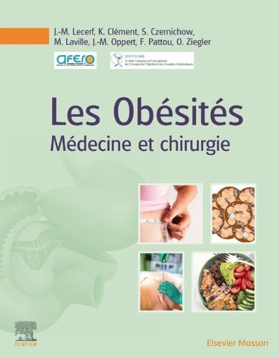 Les obésités : médecine et chirurgie