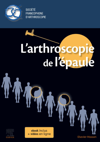 L'arthroscopie de l'épaule