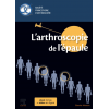 L'arthroscopie de l'épaule