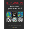 Neuro-imagerie : pathologies du système nerveux central