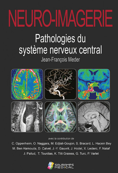 Neuro-imagerie : pathologies du système nerveux central