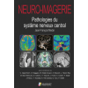 Neuro-imagerie : pathologies du système nerveux central