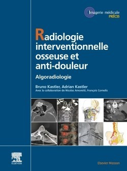 Radiologie interventionnelle osseuse et anti-douleur