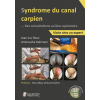 Syndrome du canal carpien