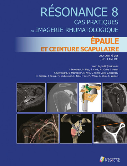 Résonance 8 : épaule et ceinture scapulaire