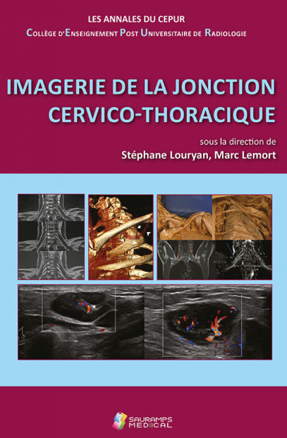 Imagerie de la jonction cervico-thoracique