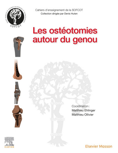 Les ostéotomies autour du genou