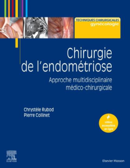 Chirurgie de l'endométriose