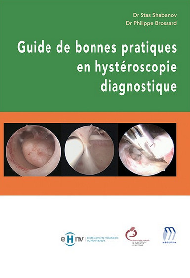 Guide de bonnes pratiques en hystéroscopie diagnostique