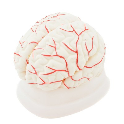 Cerveau avec artères