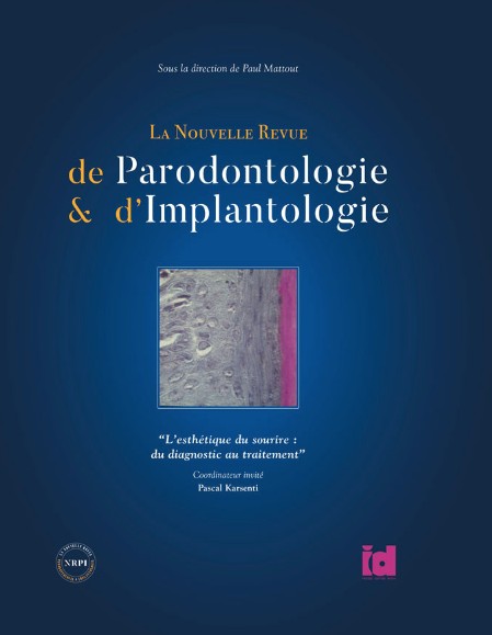 Nouvelle revue de parodontologie et implantologie, volume 2
