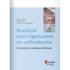 Brackets auto-ligaturants en orthodontie