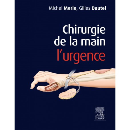 Chirurgie de la main : l'urgence