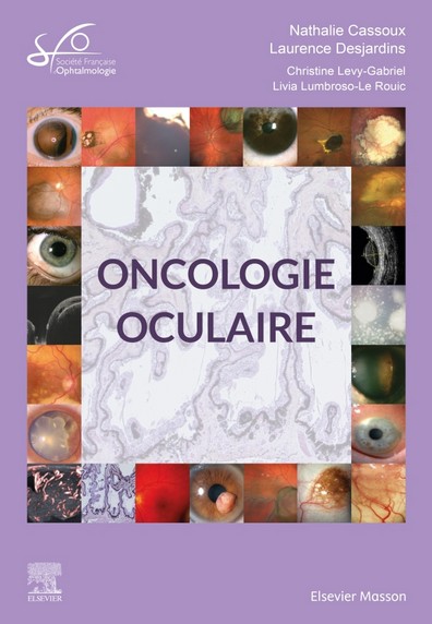 Oncologie oculaire - Rapport SFO 2022