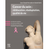 Cancer du sein : rééducation, réadaptation, qualité de vie