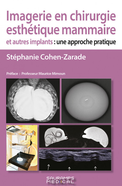 Imagerie en chirurgie esthétique mammaire et autres implants