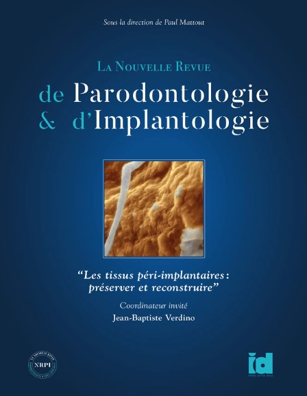 Revue de parodontologie et implantologie, volume 4