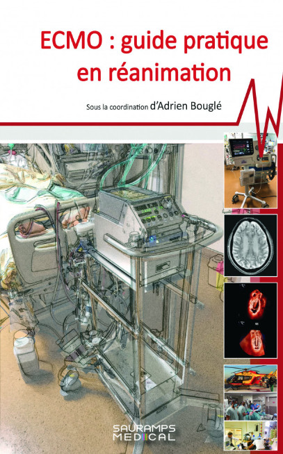 ECMO : guide pratique en réanimation