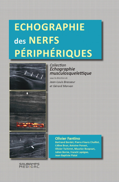 Echographie des nerfs périphériques