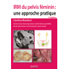 IRM du pelvis féminin : une approche pratique