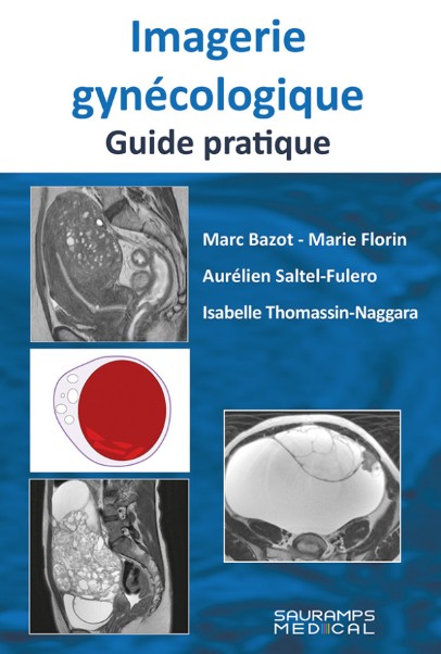 Imagerie gynécologique : guide pratique