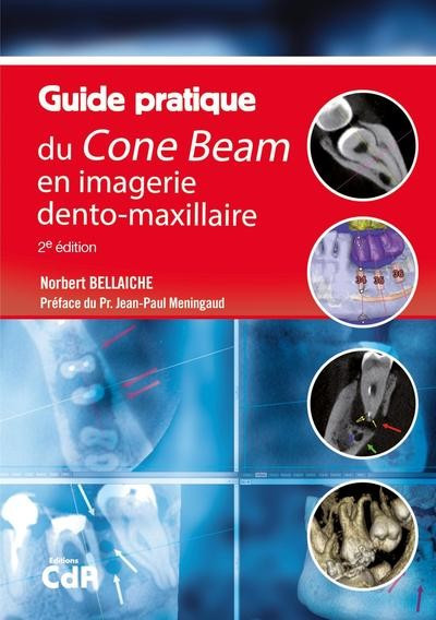 Guide pratique du cone beam en imagerie dento-maxillaire