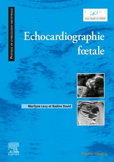 Echocardiographie fœtale