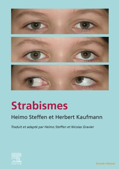 Strabismes