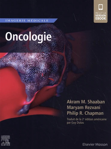 Oncologie