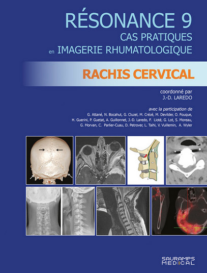 Résonance 9 : rachis cervical