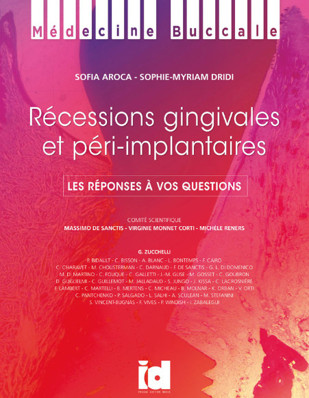 Récessions gingivales et péri-implantaires