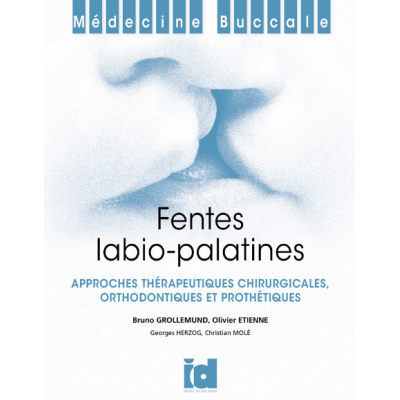 Fentes labio-palatines