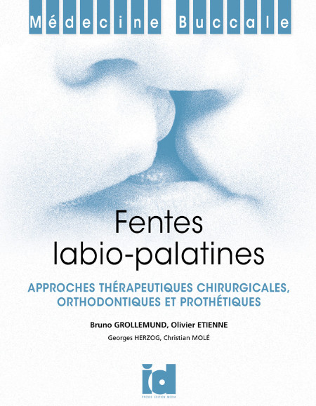 Fentes labio-palatines