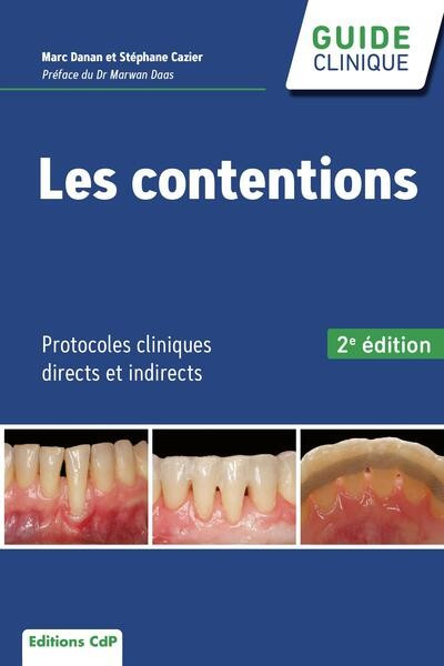 Les contentions