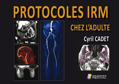 Pack protocoles IRM + scanner chez l'adulte