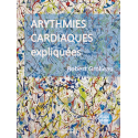 Arythmies cardiaques expliquées