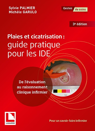 Plaies et cicatrisation : guide pratique pour les IDE