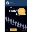 L\'arthroscopie du genou