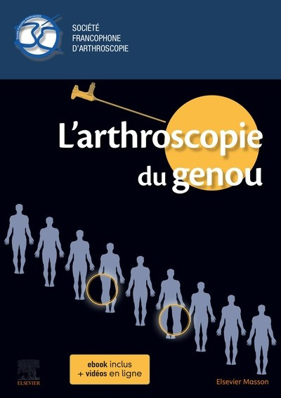 L'arthroscopie du genou