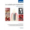 Les maladies péri-implantaires